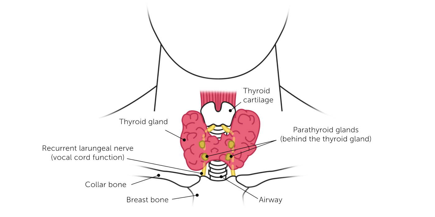 Image depicting thyroidectomy surgery