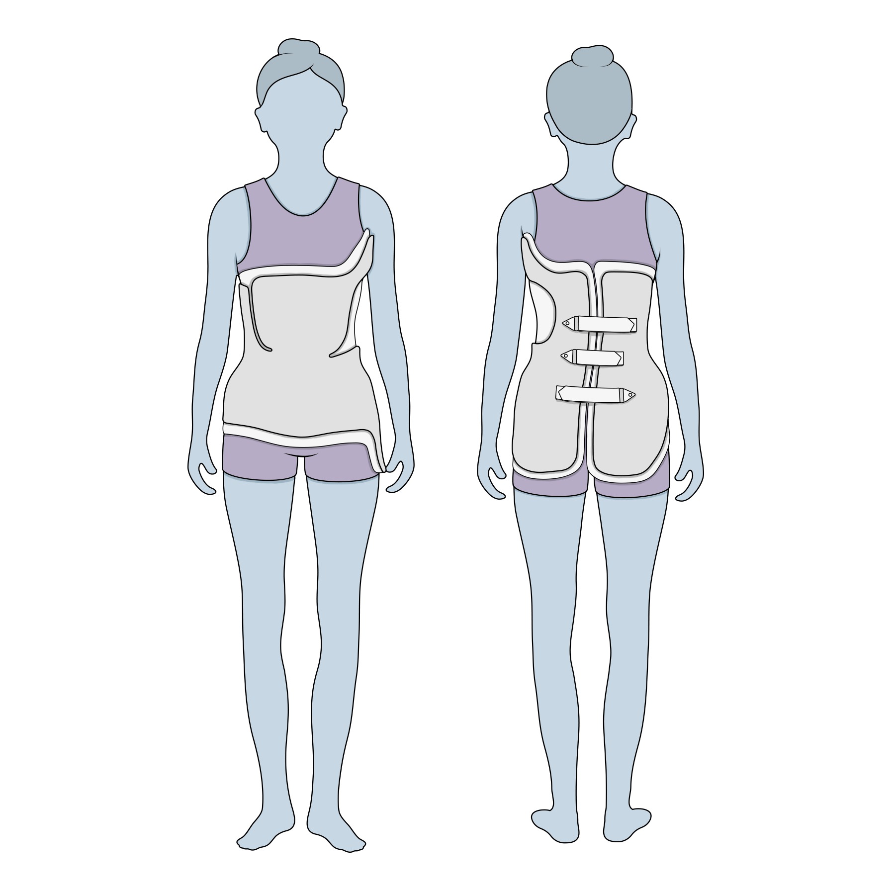 Illustration: A scoliosis brace wraps around a child's torso, with straps in the back.
