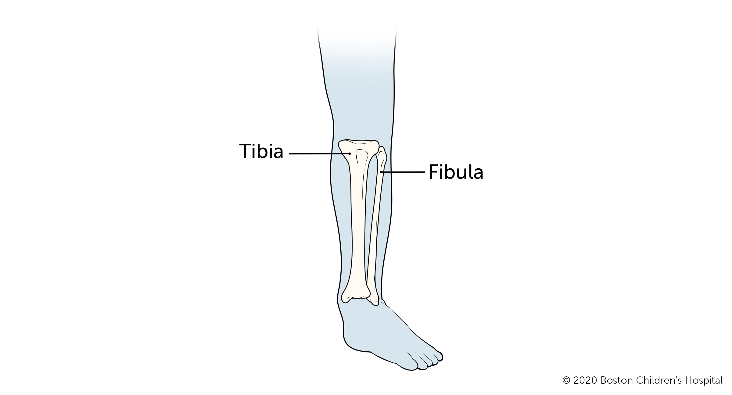 Illustration of where tibia and fibula are located on the leg