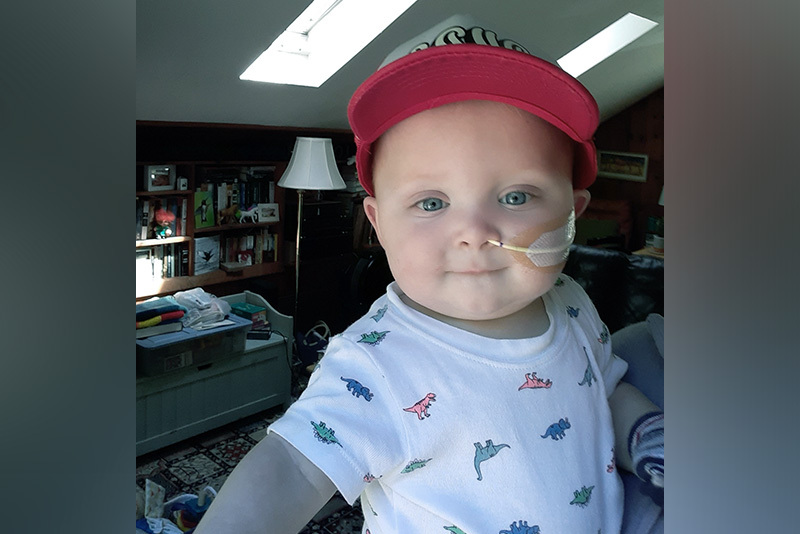 Baby Mile's wears a dinosaur shirt and shows up his nasagastric (NG) tube that helps him receive his nutrition.