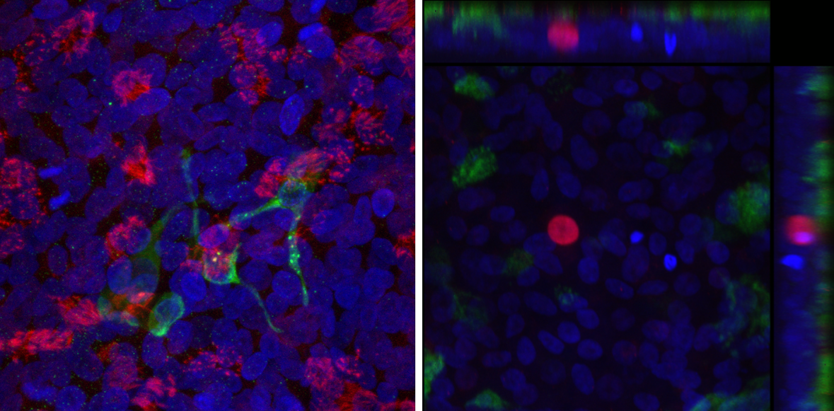 Cells under a microscope.
