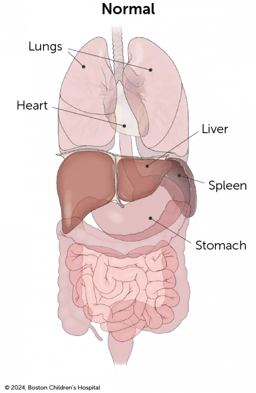 An illustration shows a normal, or situs solitus, chest, and abdominal anatomy.