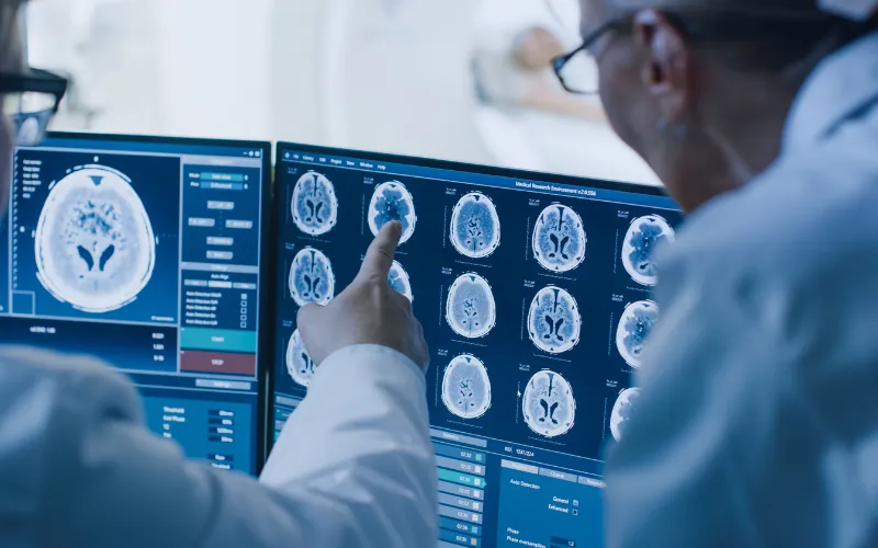 Doctors pointing at brain scans on computer