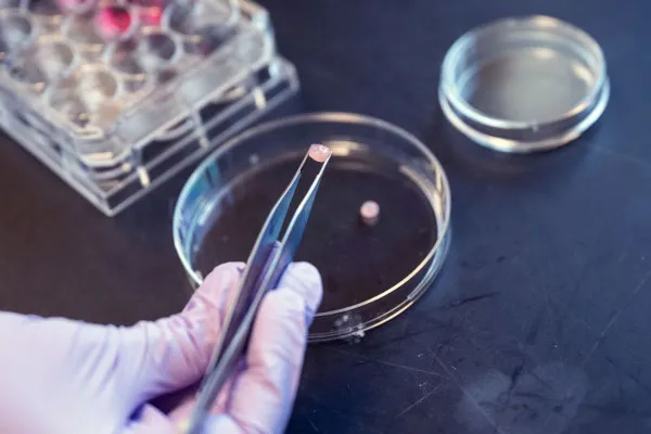 Engineered cartilage samples approximately the size of a pea.